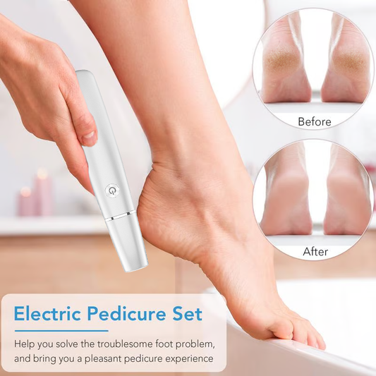 🌸Fête des mères vente chaude 50% RÉDUCTION🌸Extracteur de callosités électrique pour les pieds